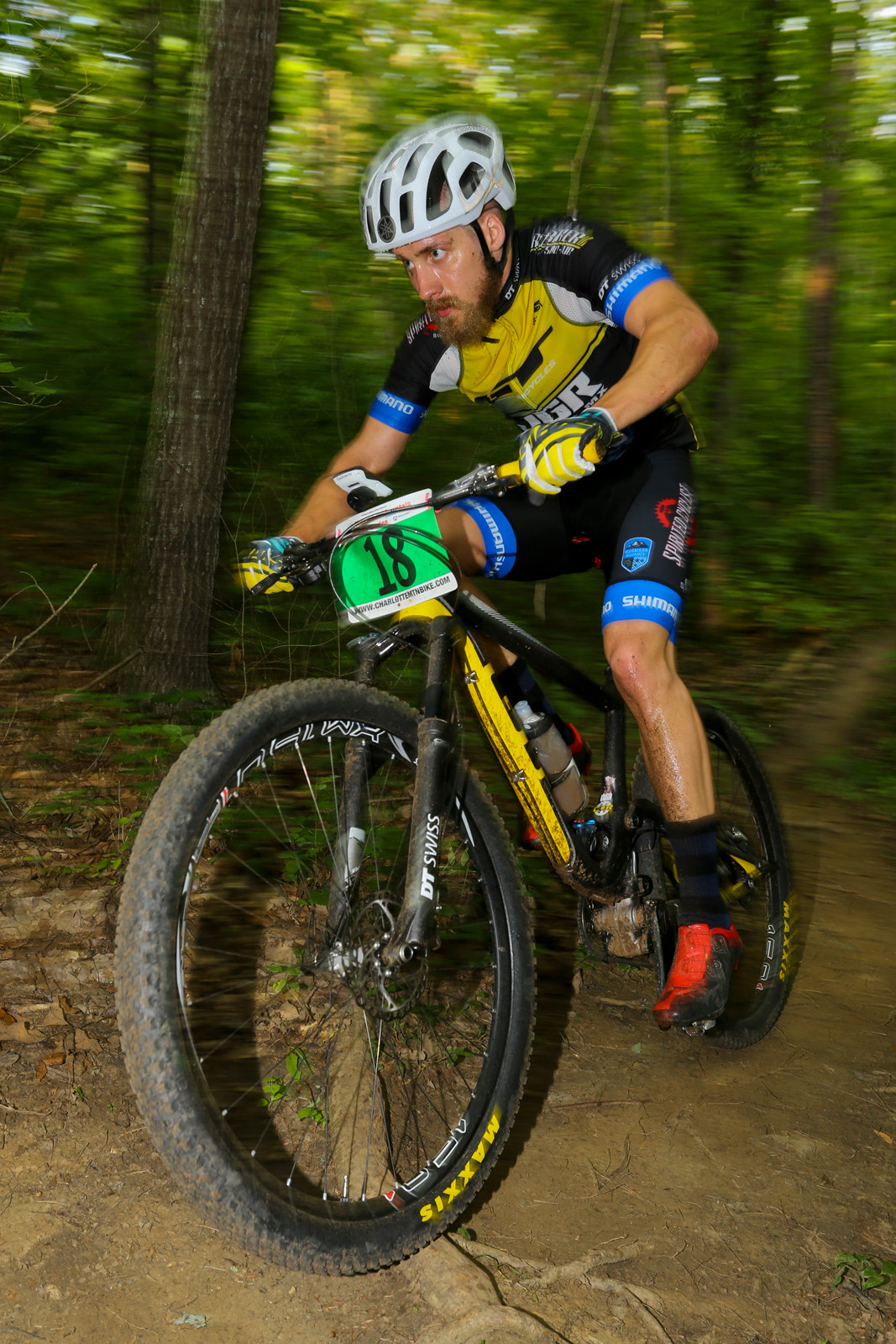 Charlotte Mountain Bike Race Series Vital MX Pit Bits High Point